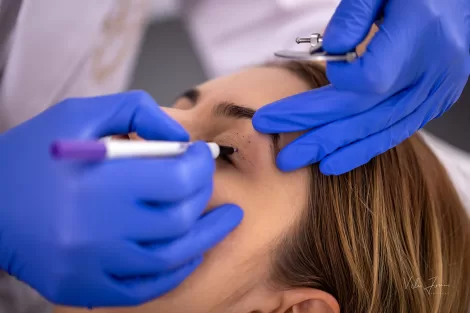 Blefaroplastie superioară București